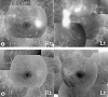 Fig. 1