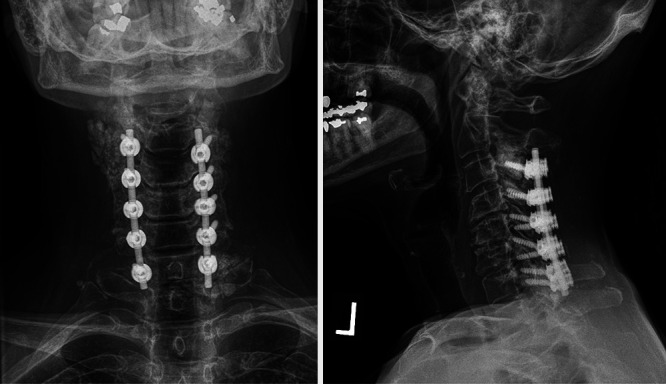 FIG. 3.