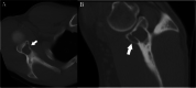 Fig. 19