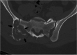 Fig. 14