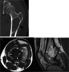 Fig. 17