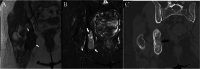 Fig. 15