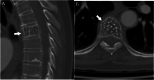 Fig. 20