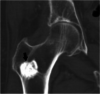 Fig. 12