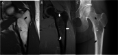 Fig. 11