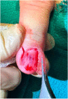Fig 2