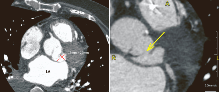 Figure 3