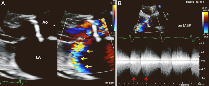 Figure 4