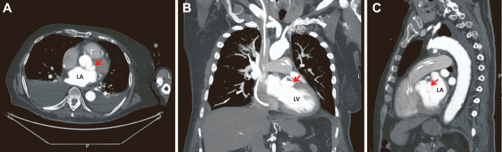 Figure 2