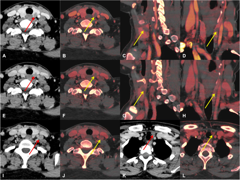 Fig. 4