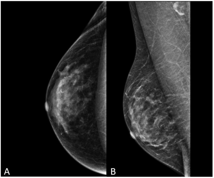 Male Breast: A Review of the Literature and Current State of the Art of ...