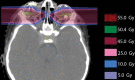 Fig. 13