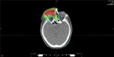 Fig. 11