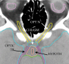Fig. 4