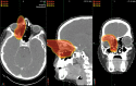 Fig. 14