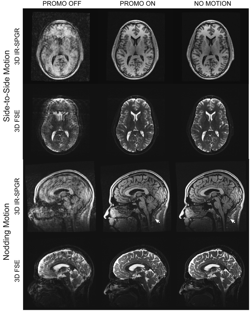 FIG. 10