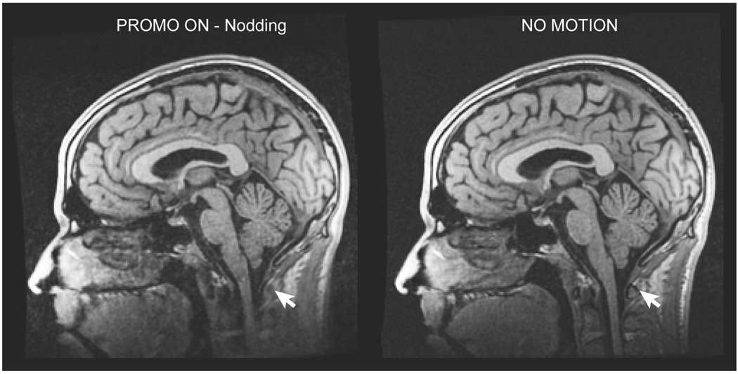 FIG. 11