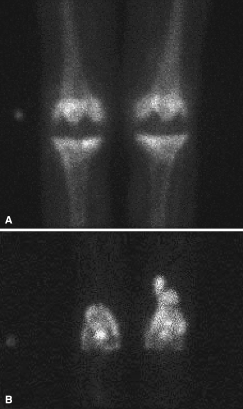 Fig. 2A–B