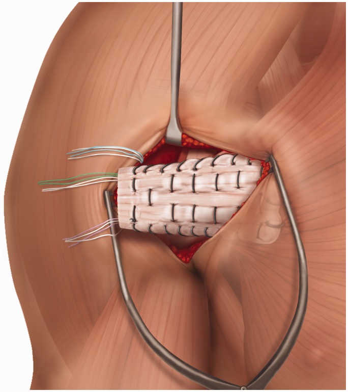 Figure 2.