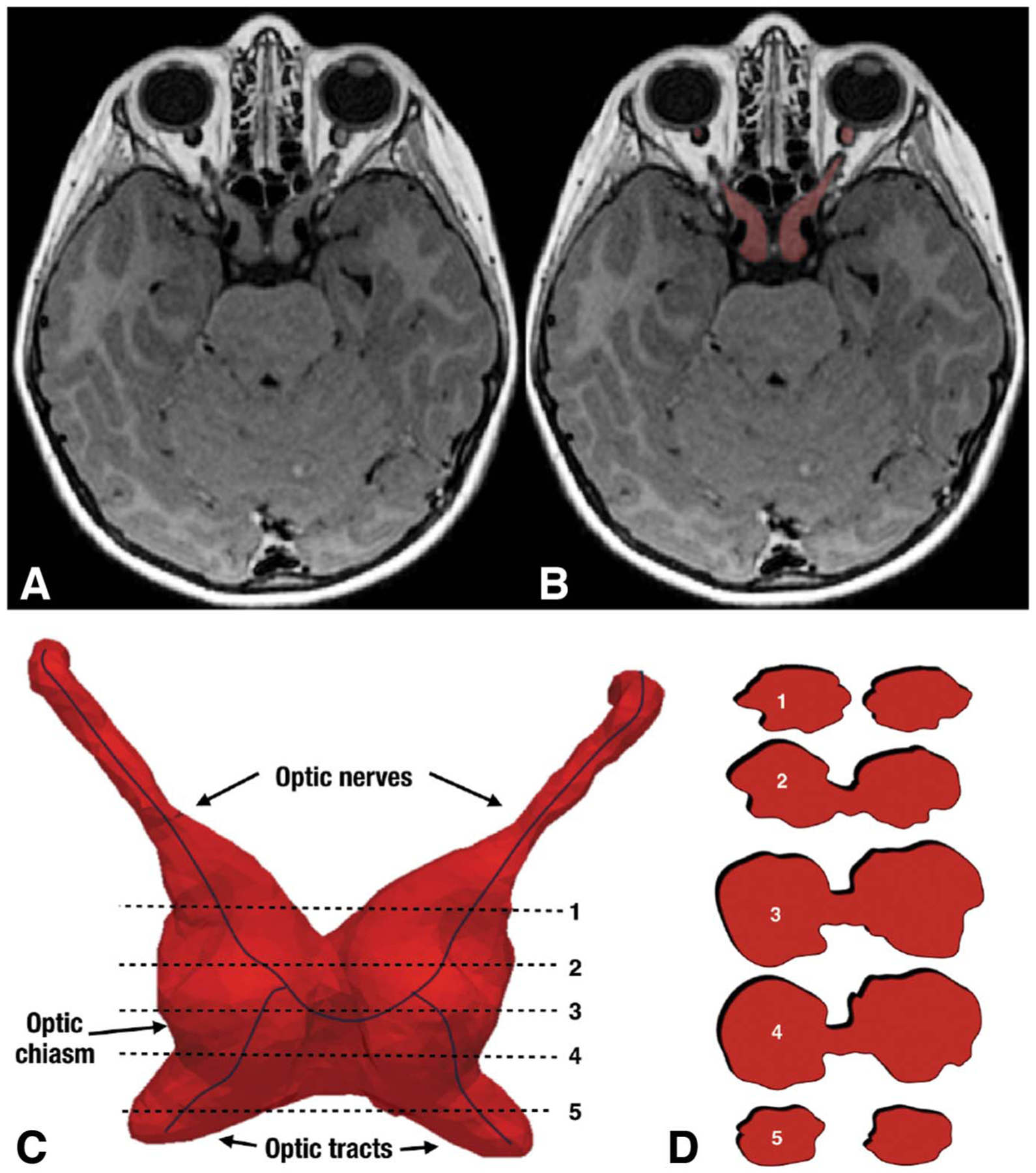 FIG. 4.