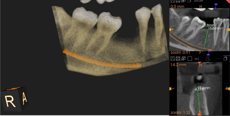 Fig. 2