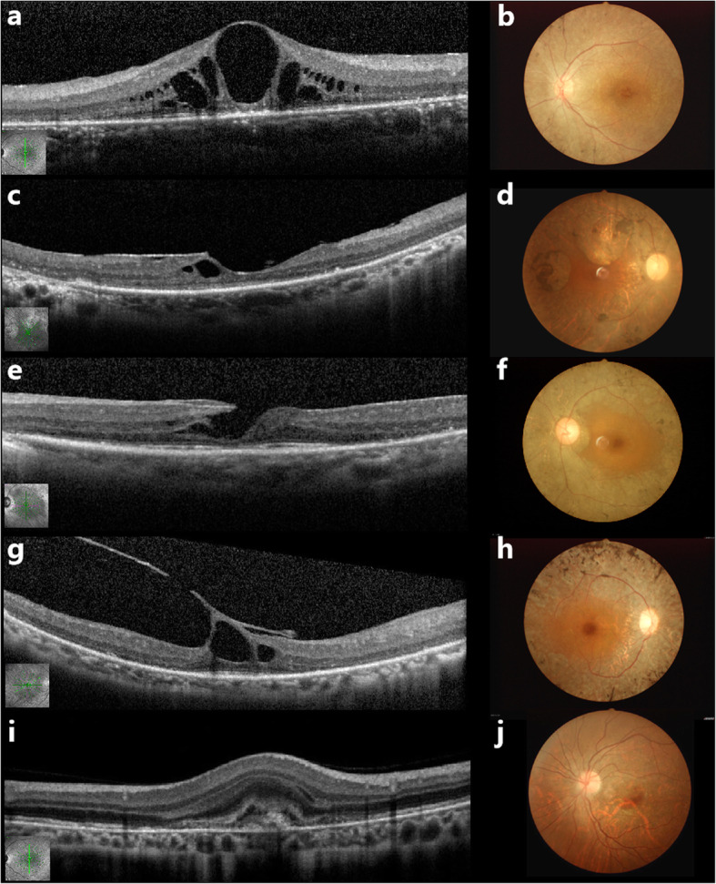 Fig. 3