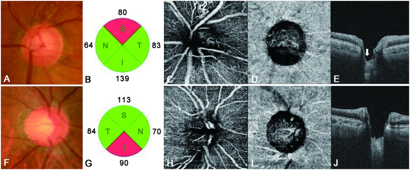 Fig 5