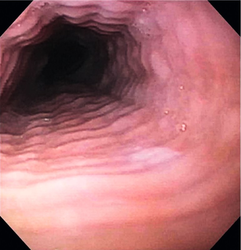Fig. 3
