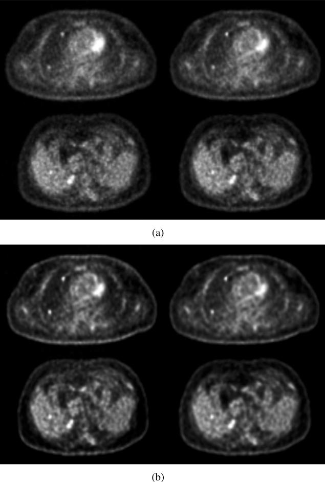 Fig. 16