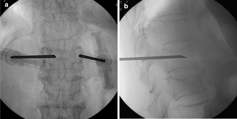 Fig. 3