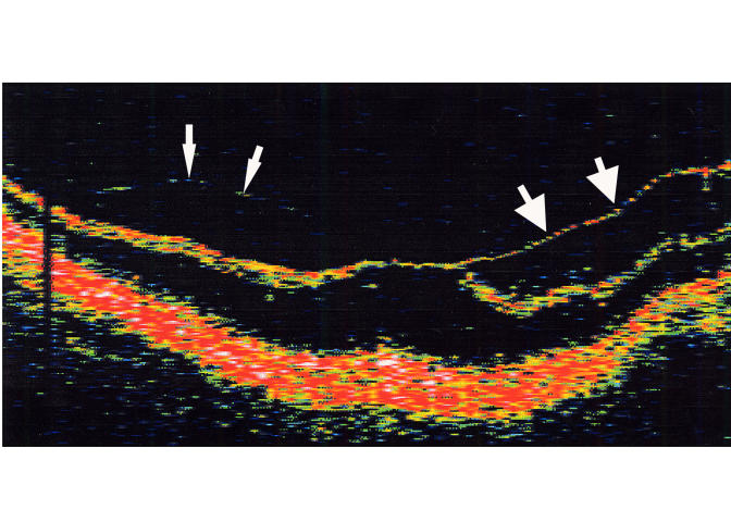 FIGURE 18B