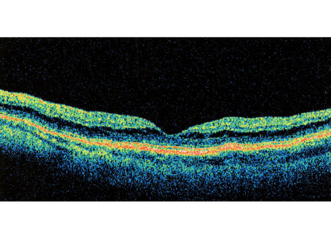 FIGURE 17D