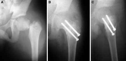 Fig. 1