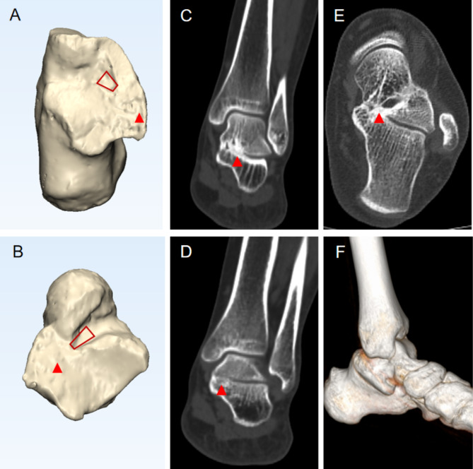 Fig. 5