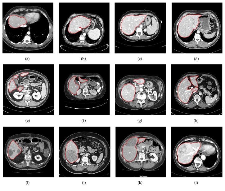 Figure 14