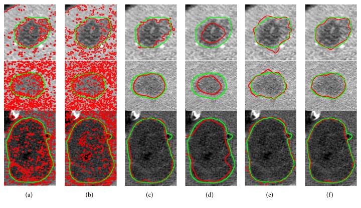 Figure 15