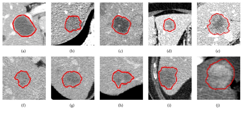 Figure 19