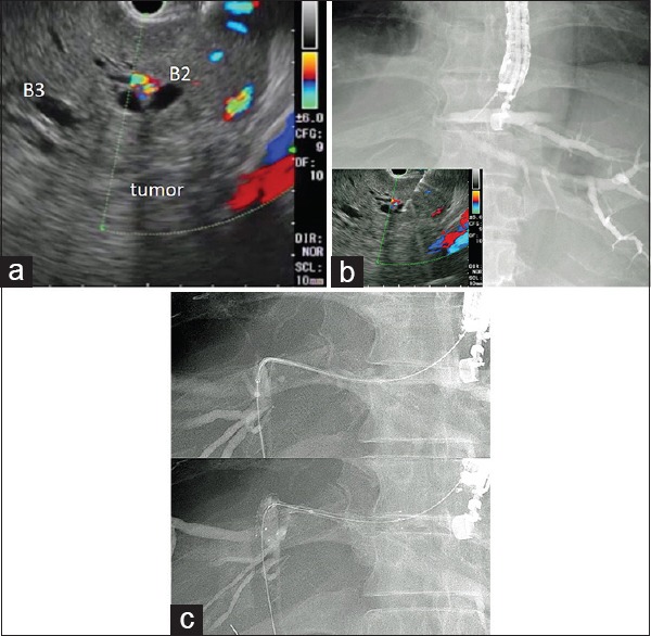 Figure 2