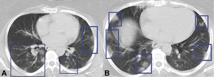 Fig 3