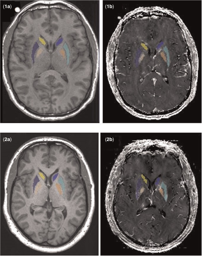 FIG. 1.