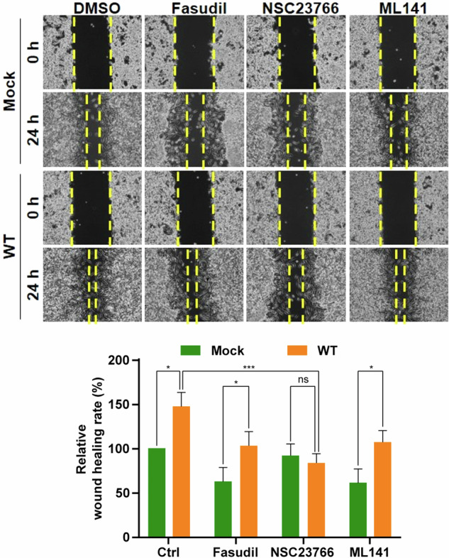 graphic file with name 12276_2025_1502_Figb_HTML.jpg