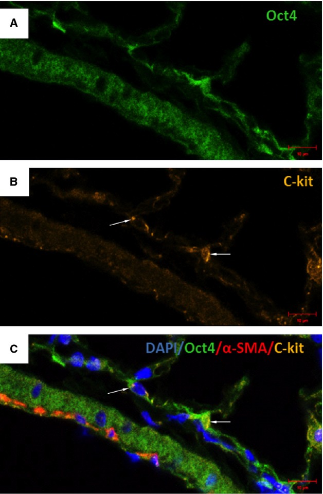 Fig. 12