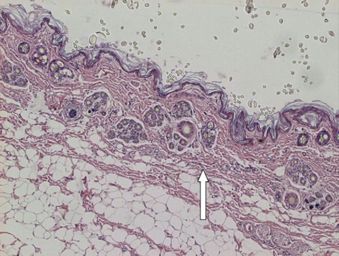 Fig 5.