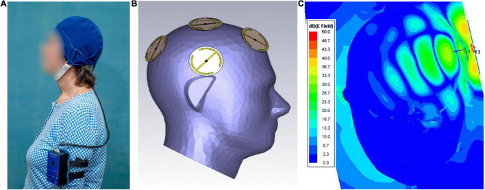 FIGURE 1