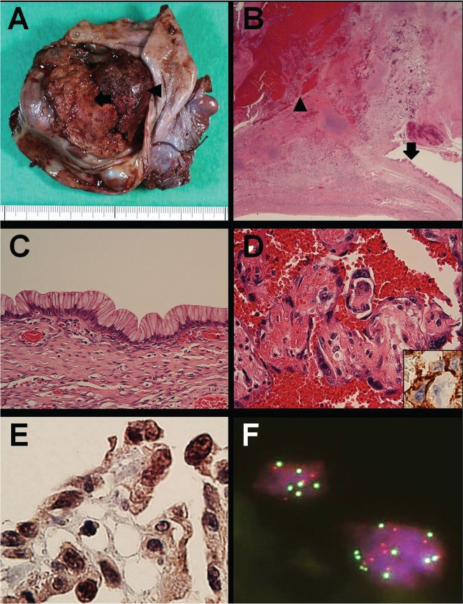 FIGURE 3