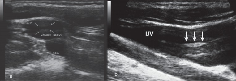 
Figure 7a
