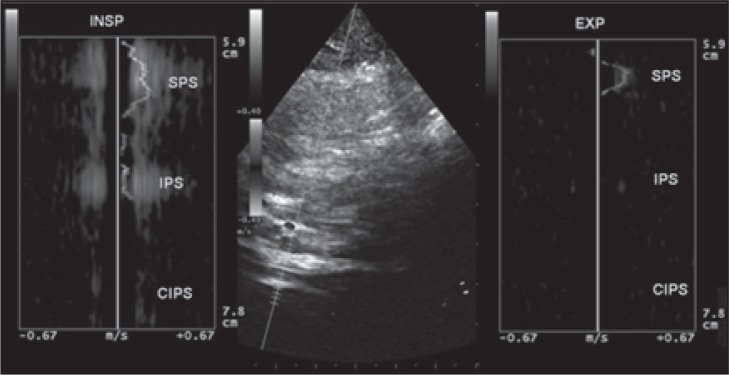 
Figure 18b
