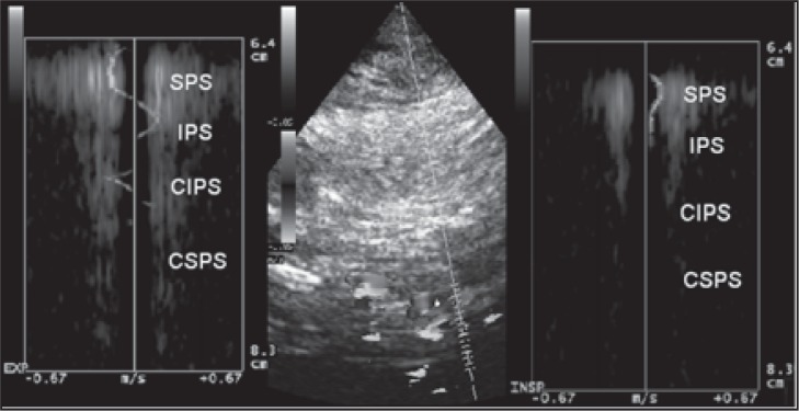 
Figure 18a
