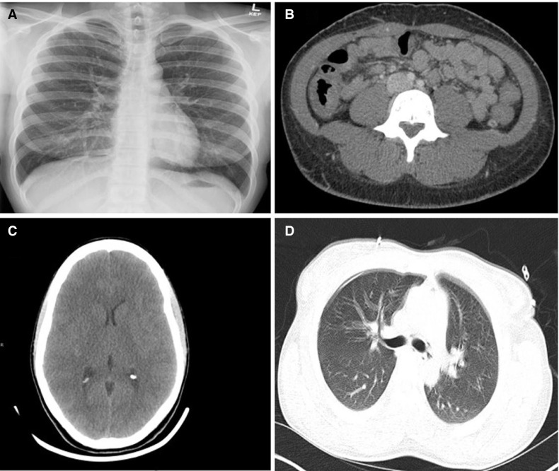 FIGURE 1