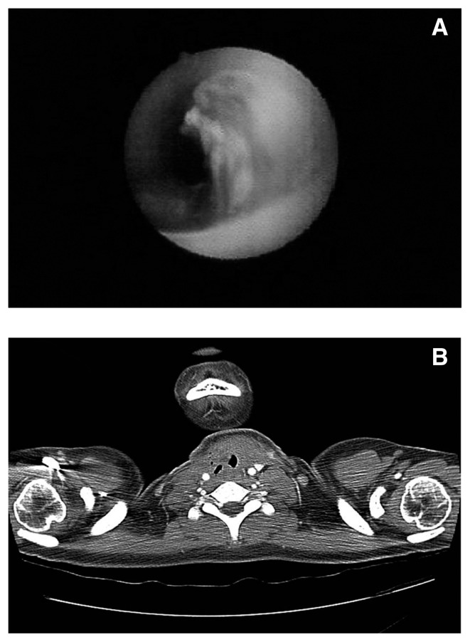 Fig. 3 A, B